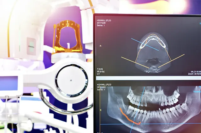 Digital X-Rays