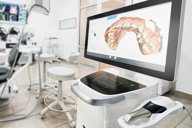 Intraoral Scanning